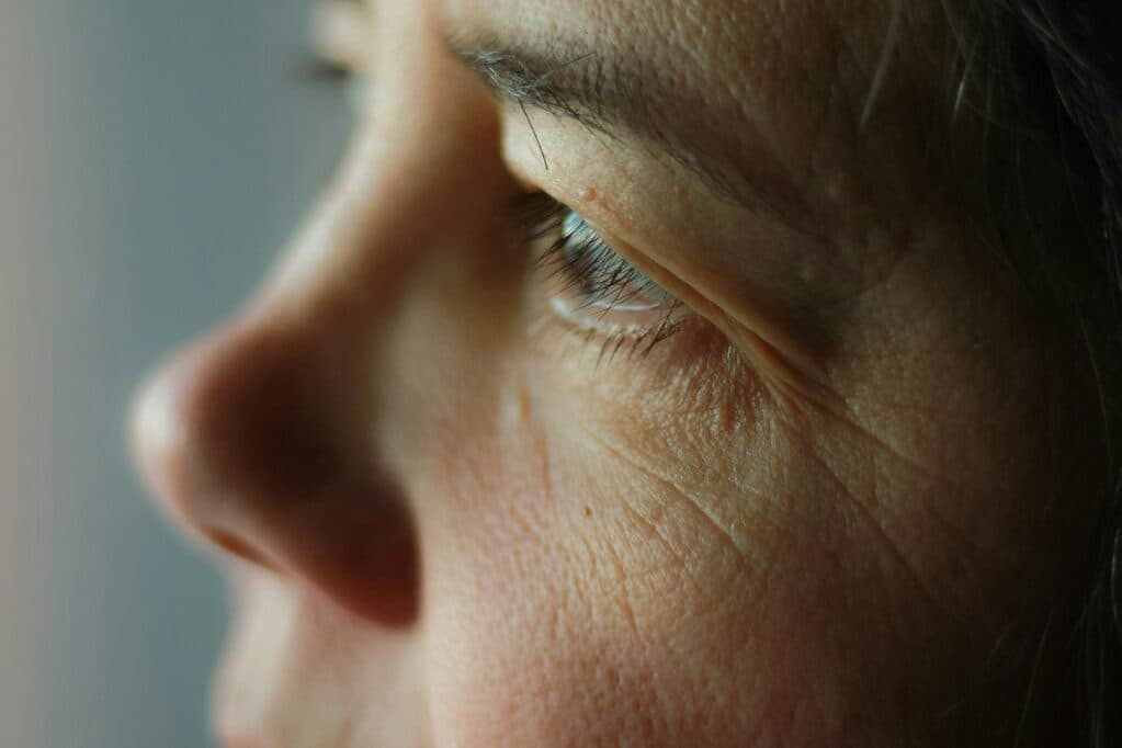 Botox Preview before