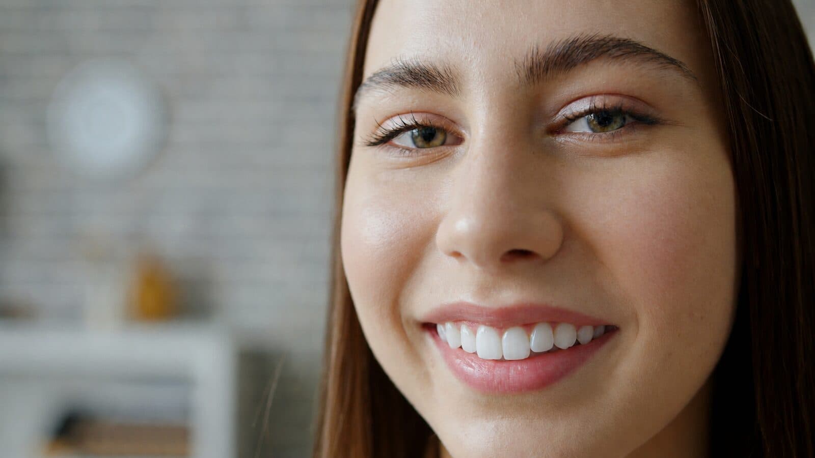 Full Smile Makeover after