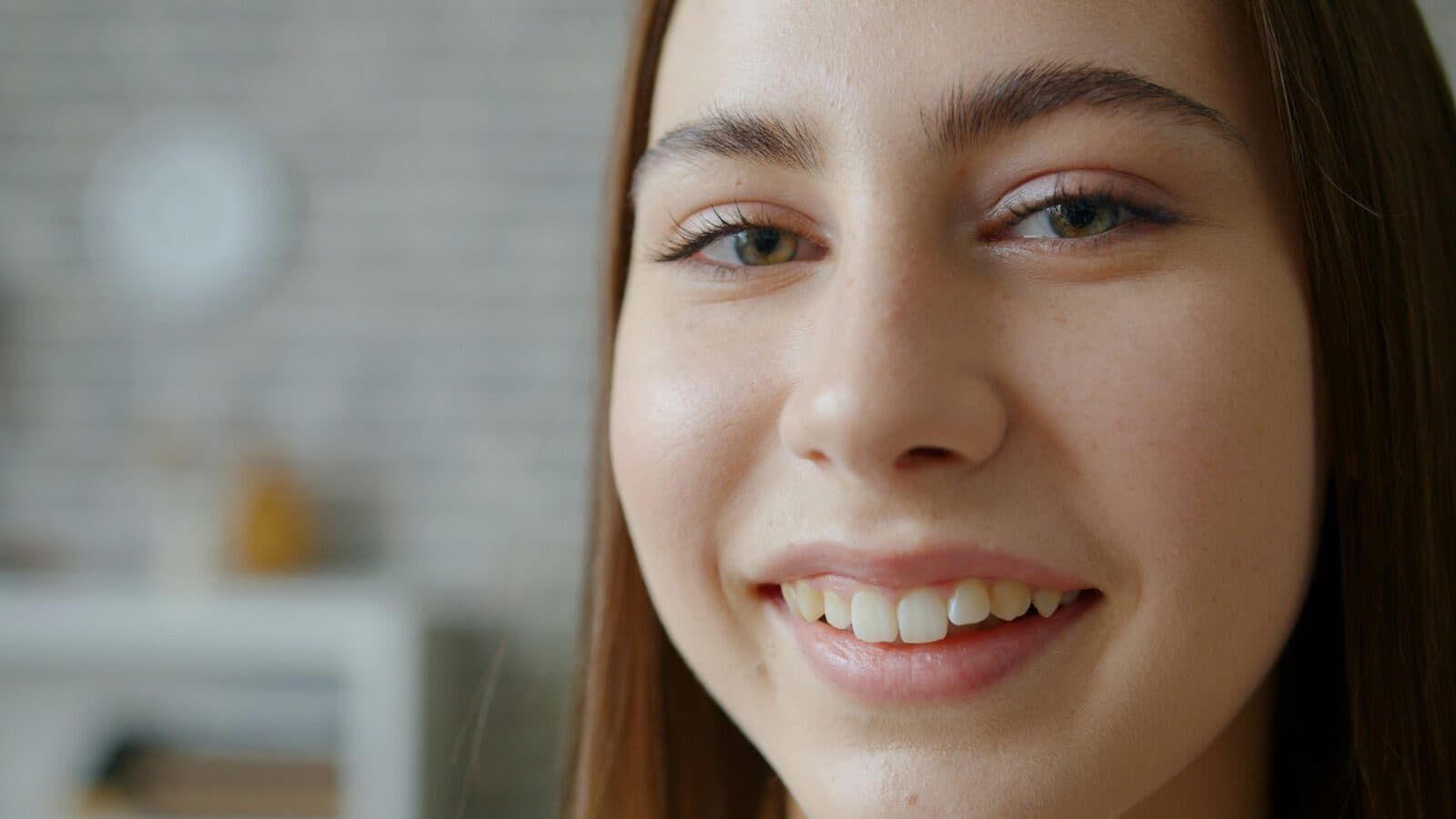 Full Smile Makeover before