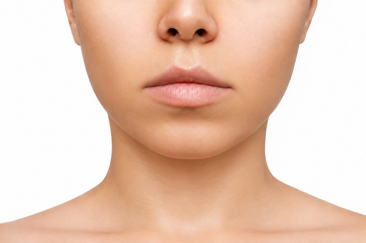 Neck/Chin Liposuction after