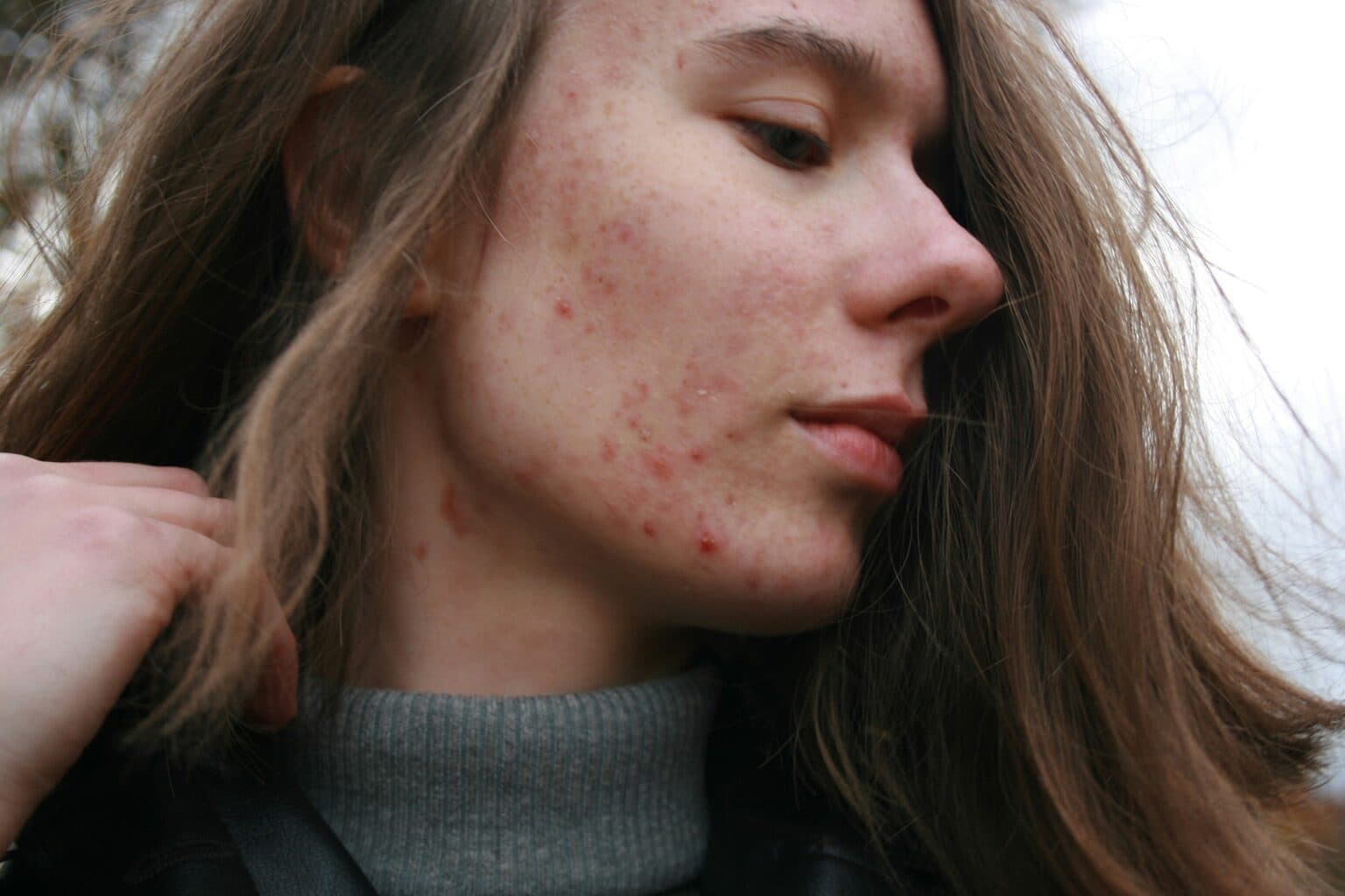 Skin Smoothing before