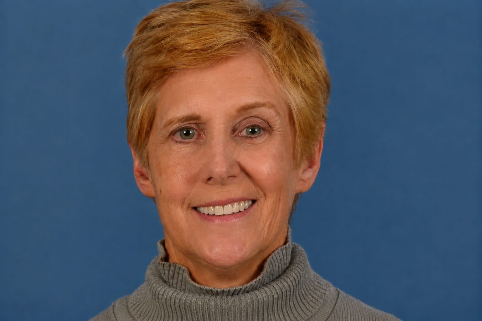 Smile Restoration after